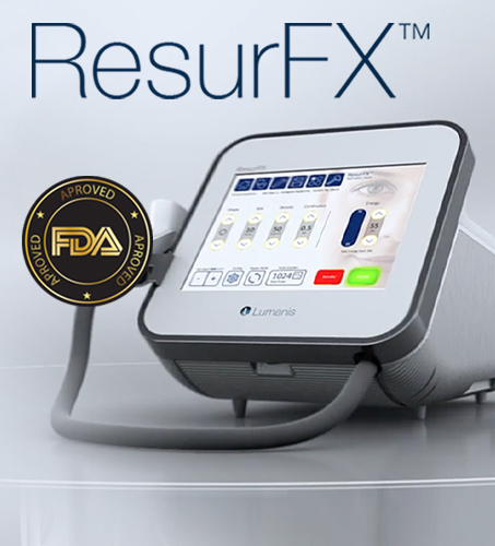 ResurFX Lumenis
